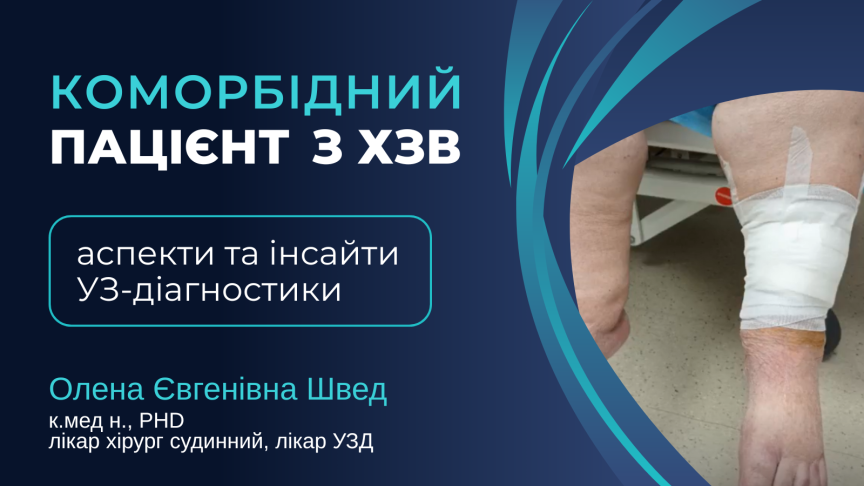 Коморбідний пацієнт з ХЗВ: аспекти та інсайти УЗ-діагностики. Відеопрактикум від Олени Євгенівни Швед 